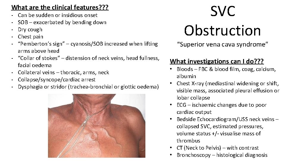 What are the clinical features? ? ? - Can be sudden or insidious onset