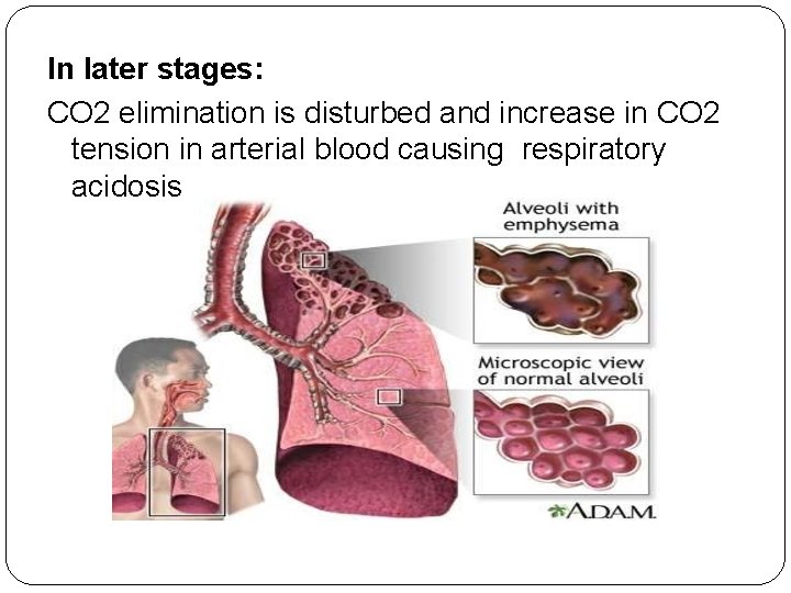 In later stages: CO 2 elimination is disturbed and increase in CO 2 tension
