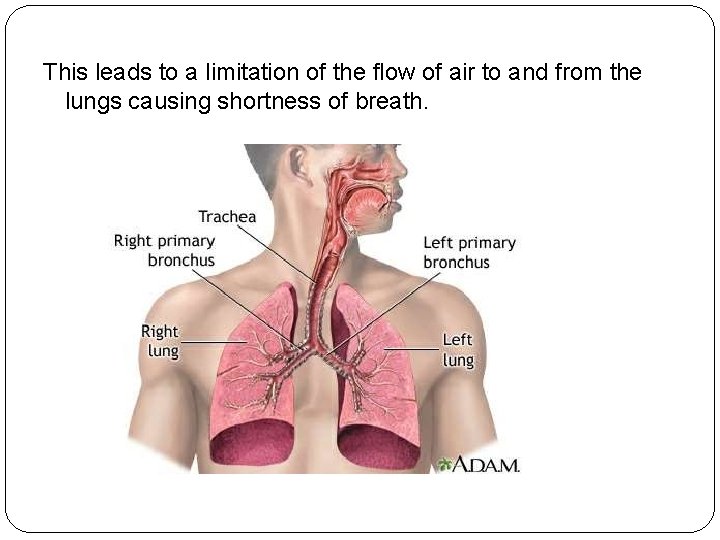 This leads to a limitation of the flow of air to and from the