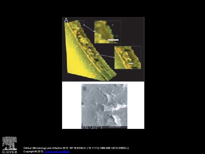 Clinical Microbiology and Infection 2012 18716 -844 DOI: (10. 1111/j. 1469 -0691. 2012. 03803.