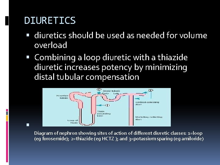 DIURETICS diuretics should be used as needed for volume overload Combining a loop diuretic