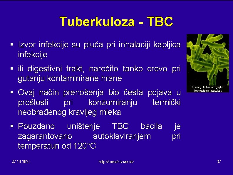 Tuberkuloza - TBC § Izvor infekcije su pluća pri inhalaciji kapljica infekcije § ili