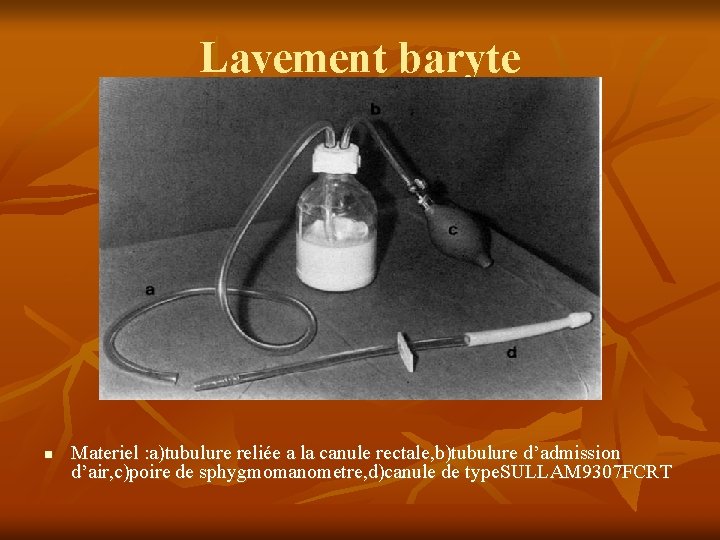 Lavement baryte n Materiel : a)tubulure reliée a la canule rectale, b)tubulure d’admission d’air,