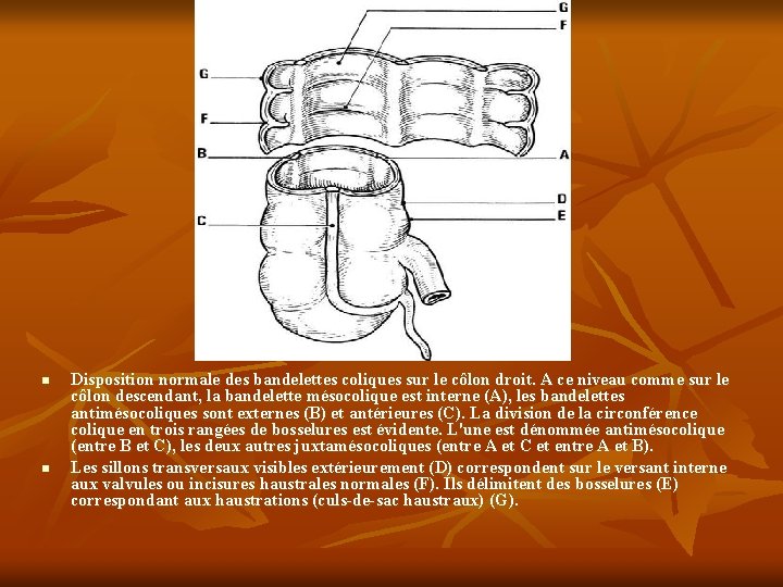 n n Disposition normale des bandelettes coliques sur le côlon droit. A ce niveau