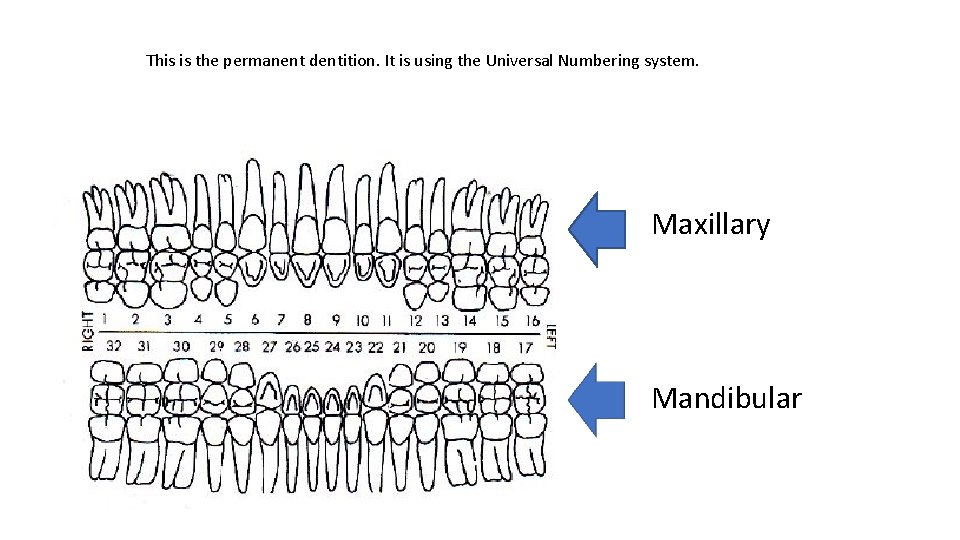 This is the permanent dentition. It is using the Universal Numbering system. Maxillary Mandibular