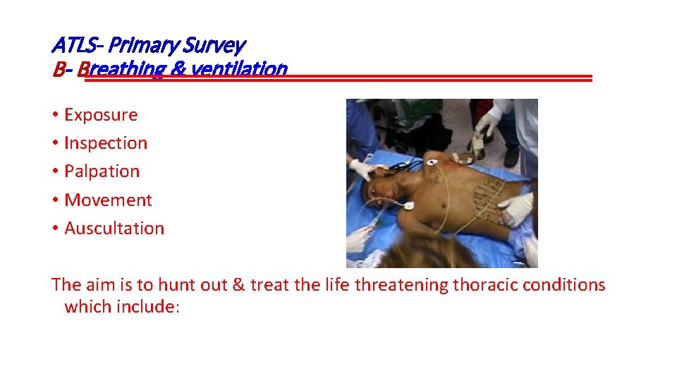 ATLS- Primary Survey B- Breathing & ventilation • Exposure • Inspection • Palpation •