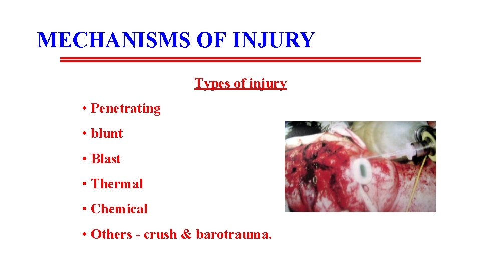 MECHANISMS OF INJURY Types of injury • Penetrating • blunt • Blast • Thermal