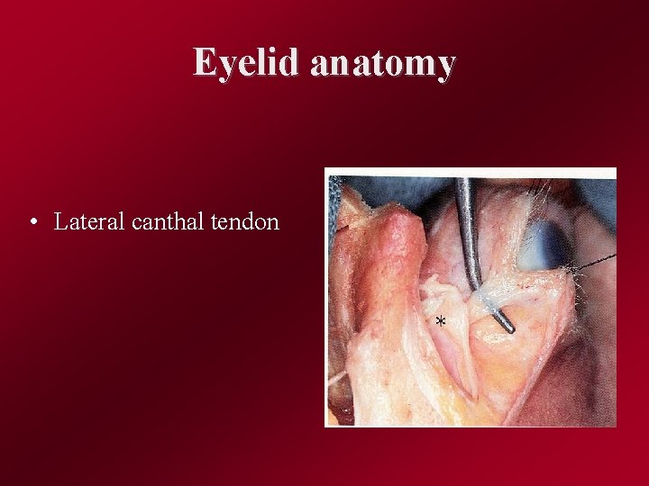 Eyelid anatomy • Lateral canthal tendon 