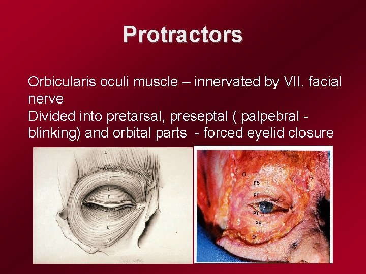 Protractors Orbicularis oculi muscle – innervated by VII. facial nerve Divided into pretarsal, preseptal