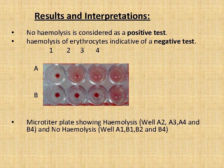 Results and Interpretations: • • No haemolysis is considered as a positive test. haemolysis