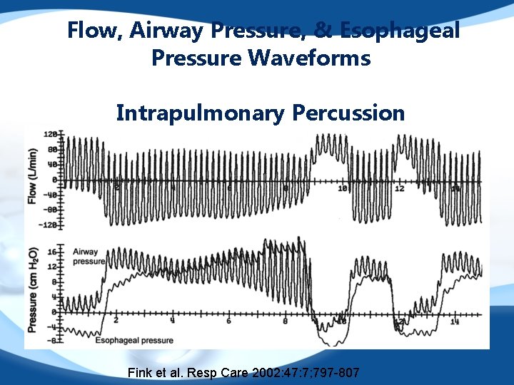 Flow, Airway Pressure, & Esophageal Pressure Waveforms Intrapulmonary Percussion Fink et al. Resp Care
