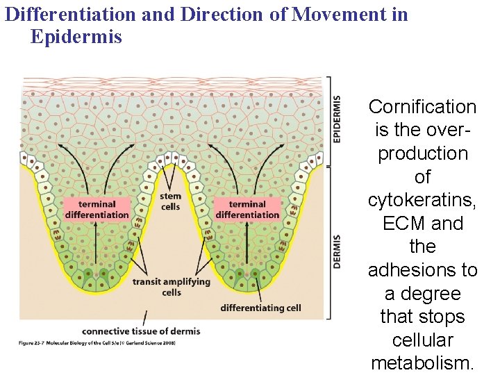 Differentiation and Direction of Movement in Epidermis Cornification is the overproduction of cytokeratins, ECM