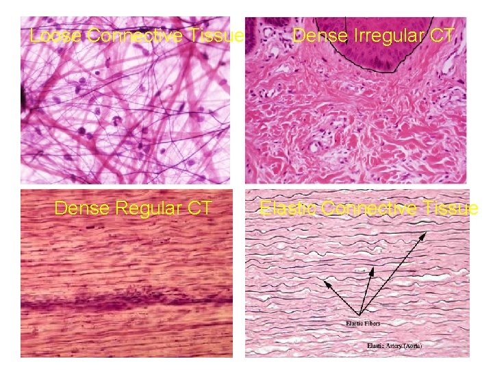 Loose Connective Tissue Dense Irregular CT Dense Regular CT Elastic Connective Tissue 