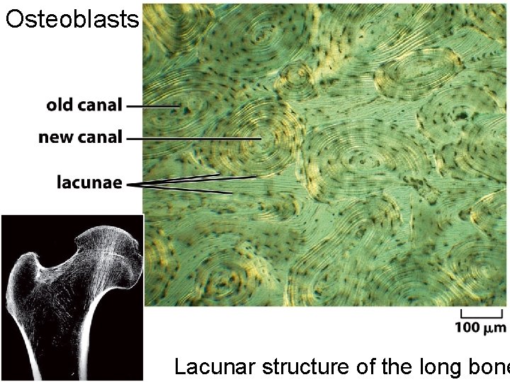 Osteoblasts Lacunar structure of the long bone 