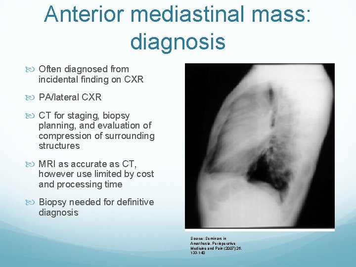 Anterior mediastinal mass: diagnosis Often diagnosed from incidental finding on CXR PA/lateral CXR CT
