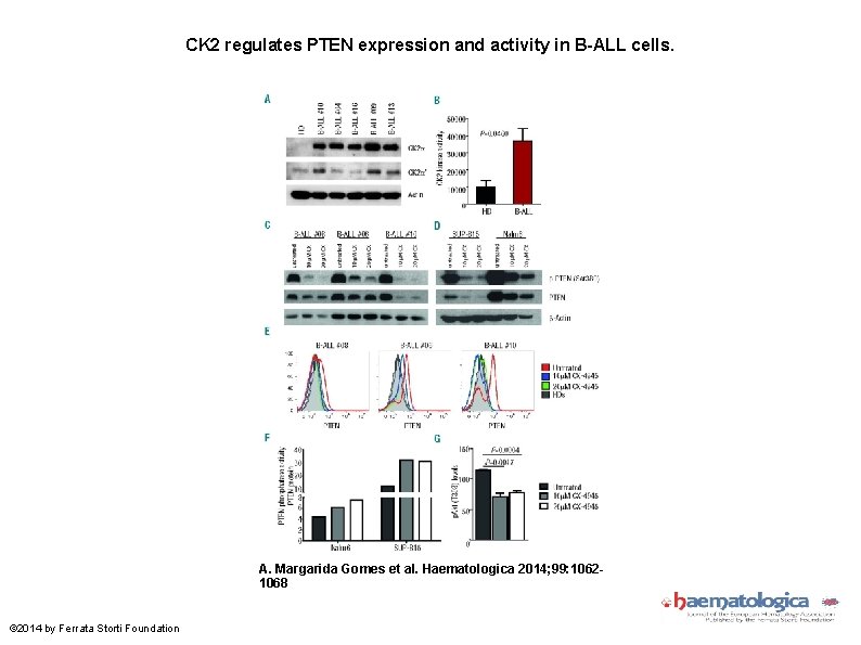 CK 2 regulates PTEN expression and activity in B-ALL cells. A. Margarida Gomes et