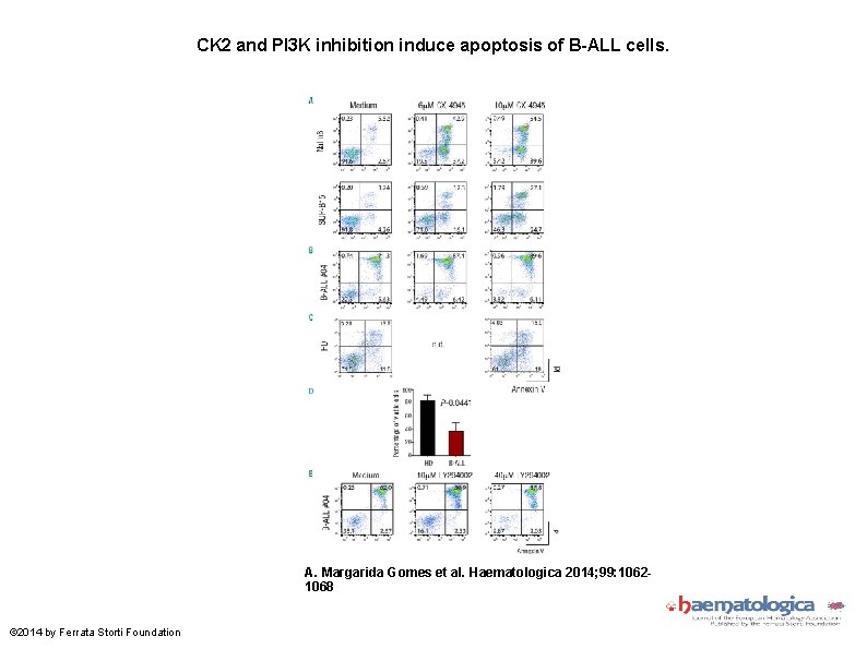 CK 2 and PI 3 K inhibition induce apoptosis of B-ALL cells. A. Margarida