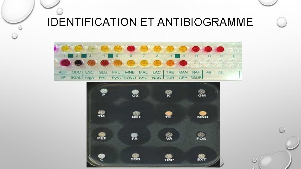 IDENTIFICATION ET ANTIBIOGRAMME 