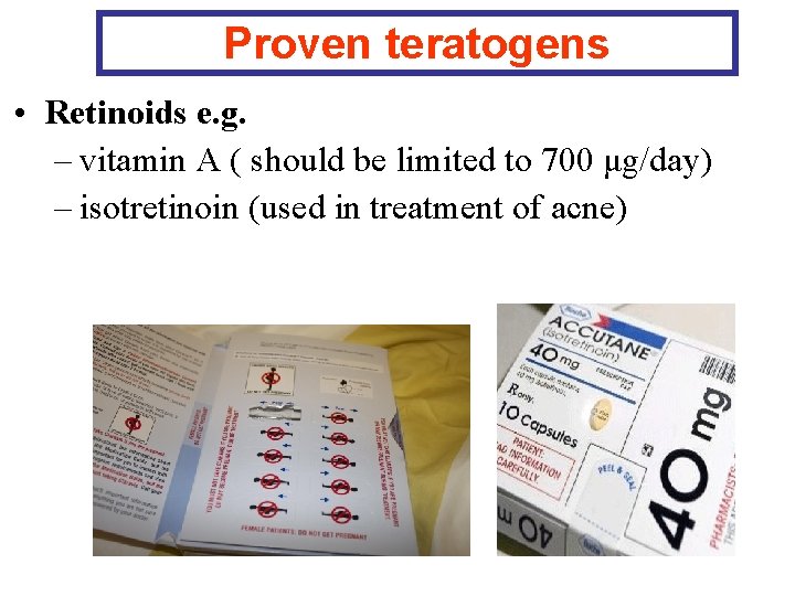 Proven teratogens • Retinoids e. g. – vitamin A ( should be limited to