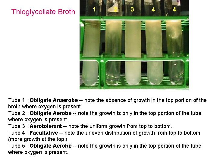 Thioglycollate Broth Tube 1 : Obligate Anaerobe -- note the absence of growth in