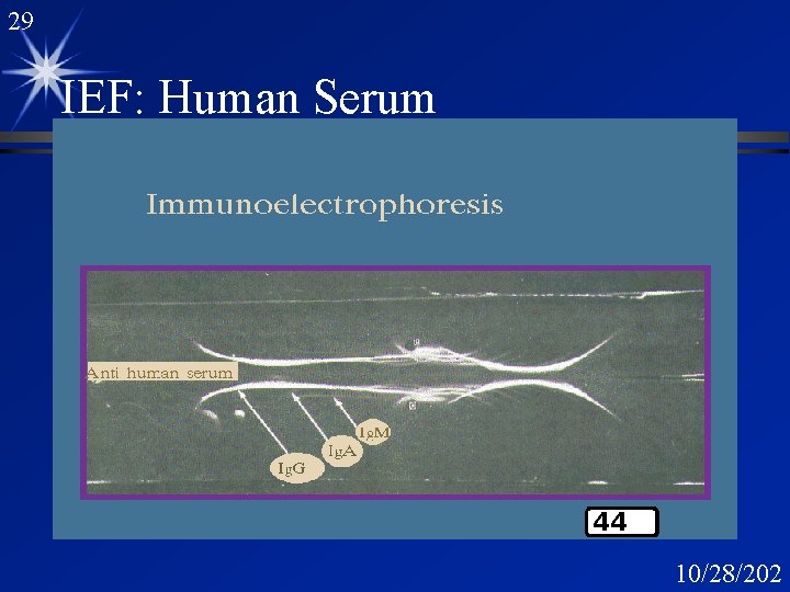 29 IEF: Human Serum 10/28/202 