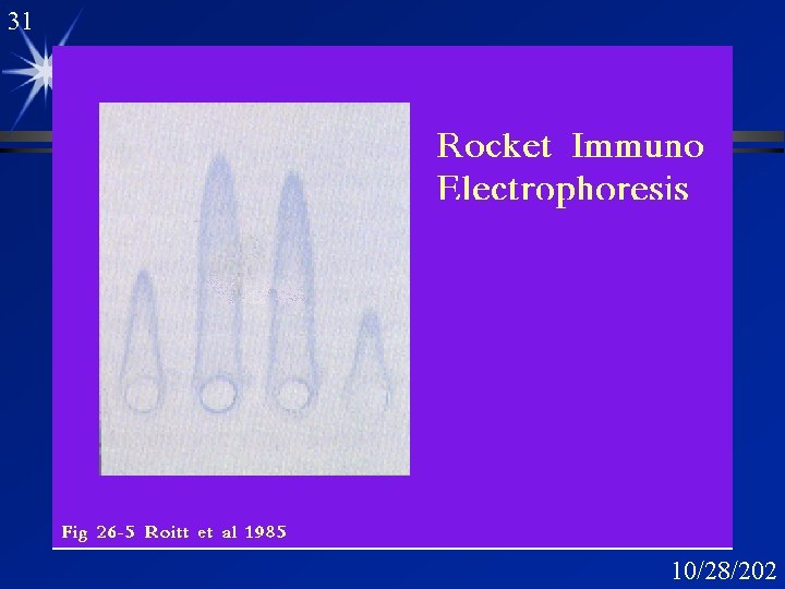 31 Rocket Immunoelectrophoresis 2 10/28/202 