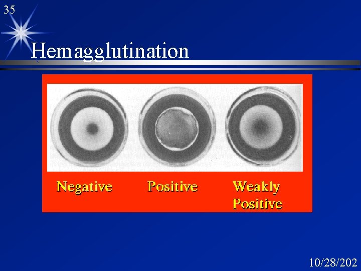 35 Hemagglutination 10/28/202 