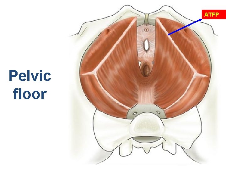 ATFP Pelvic floor 