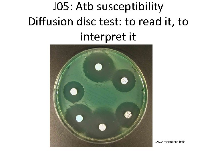 J 05: Atb susceptibility Diffusion disc test: to read it, to interpret it www.