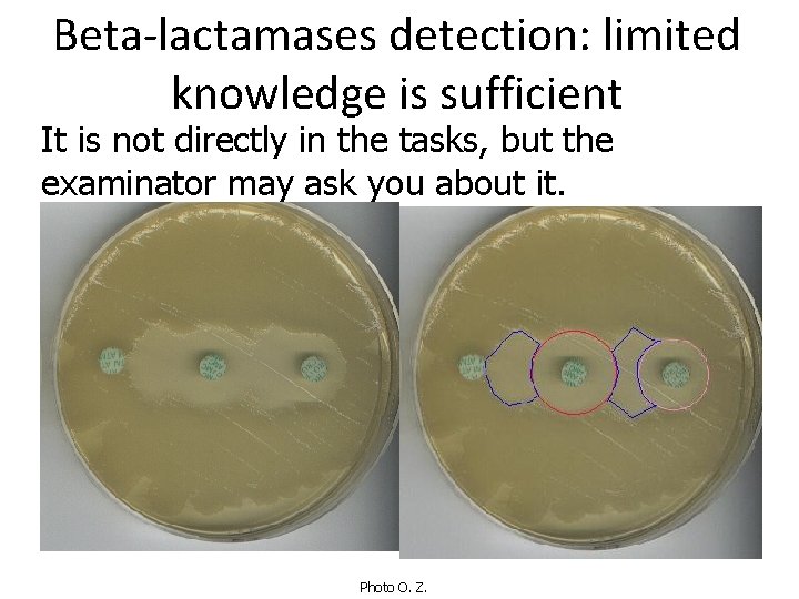 Beta-lactamases detection: limited knowledge is sufficient It is not directly in the tasks, but