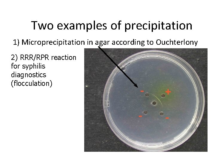 Two examples of precipitation 1) Microprecipitation in agar according to Ouchterlony 2) RRR/RPR reaction