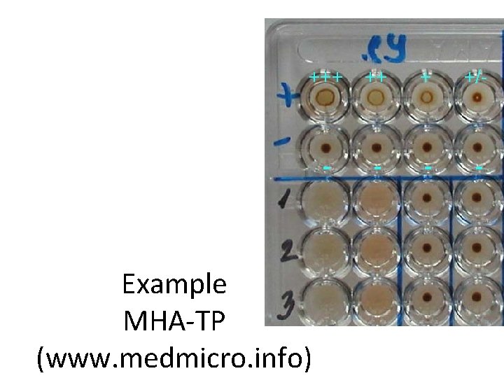 +++ ++ + +/- - - Example MHA-TP (www. medmicro. info) 