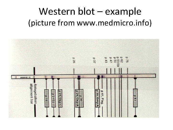 Western blot – example (picture from www. medmicro. info) 