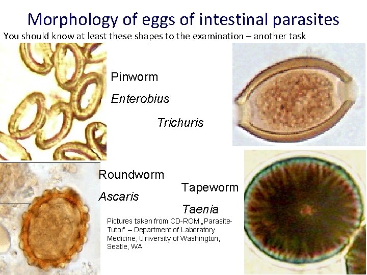 Morphology of eggs of intestinal parasites You should know at least these shapes to