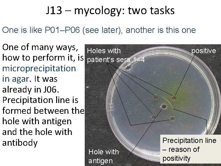 J 13 – mycology: two tasks One is like P 01–P 06 (see later),