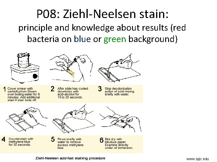 P 08: Ziehl-Neelsen stain: principle and knowledge about results (red bacteria on blue or