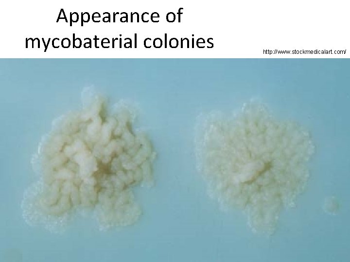 Appearance of mycobaterial colonies http: //www. stockmedicalart. com/ 