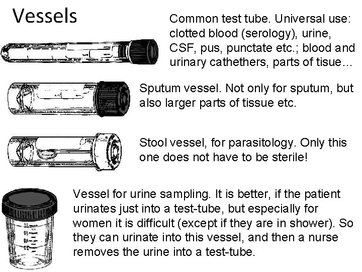 Vessels Common test tube. Universal use: clotted blood (serology), urine, CSF, pus, punctate etc.