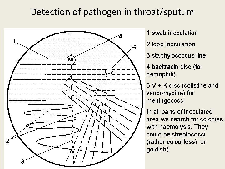 Detection of pathogen in throat/sputum 1 swab inoculation 2 loop inoculation 3 staphylococcus line