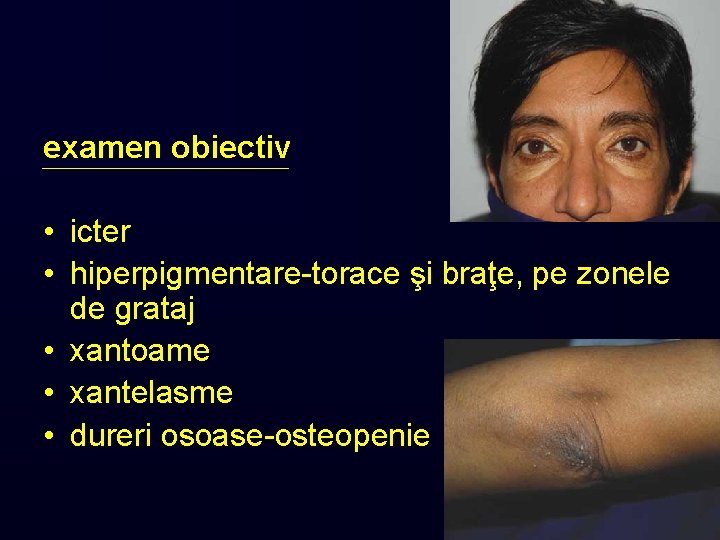 examen obiectiv • icter • hiperpigmentare-torace şi braţe, pe zonele de grataj • xantoame