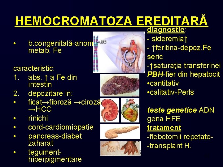 HEMOCROMATOZA EREDITARĂ • b. congenitală-anom. metab. Fe caracteristic: 1. abs. ↑ a Fe din