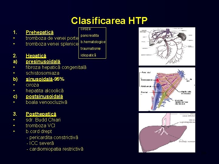 Clasificarea HTP ciroza 1. • • Prehepatică tromboza de venei porte tromboza venei splenice