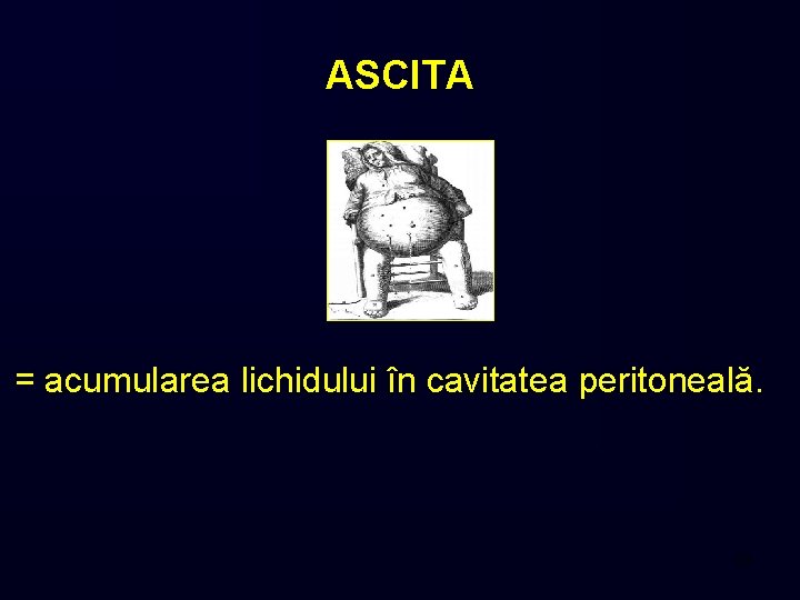 ASCITA = acumularea lichidului în cavitatea peritoneală. 49 