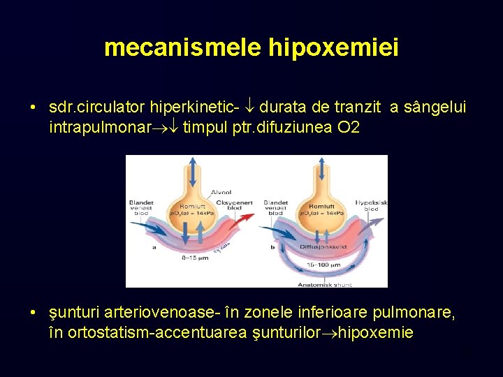 mecanismele hipoxemiei • sdr. circulator hiperkinetic- durata de tranzit a sângelui intrapulmonar timpul ptr.