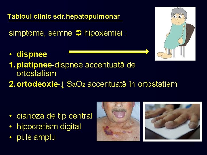 Tabloul clinic sdr. hepatopulmonar simptome, semne hipoxemiei : • dispnee 1. platipnee-dispnee accentuată de