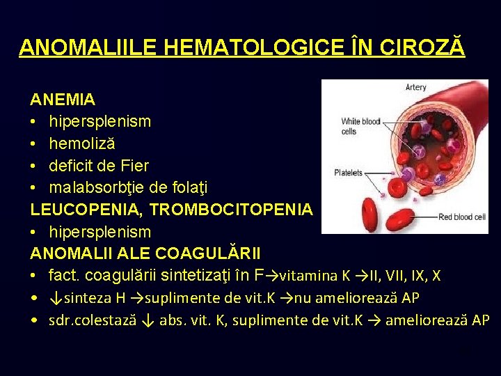 ANOMALIILE HEMATOLOGICE ÎN CIROZĂ ANEMIA • hipersplenism • hemoliză • deficit de Fier •