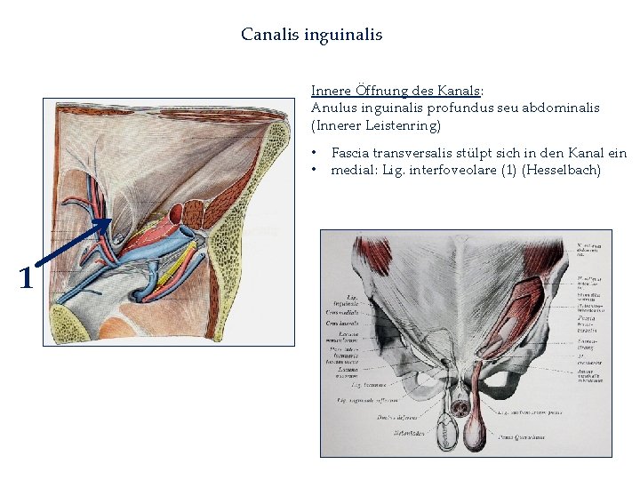 Canalis inguinalis Innere Öffnung des Kanals: Anulus inguinalis profundus seu abdominalis (Innerer Leistenring) •