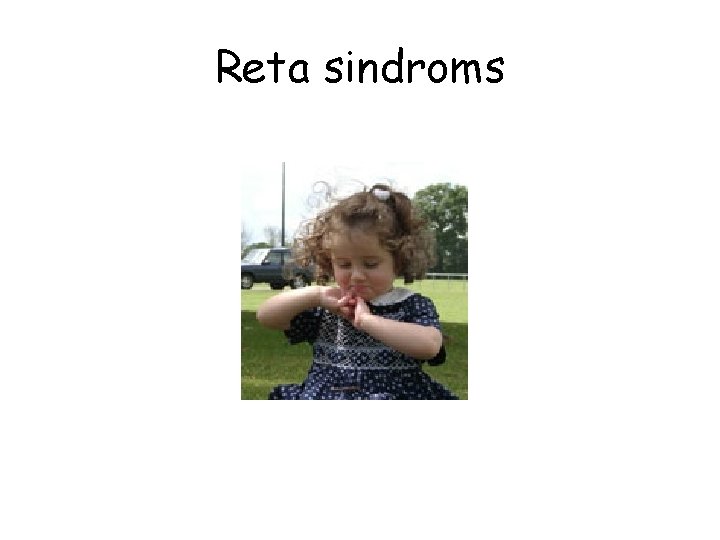 Reta sindroms 