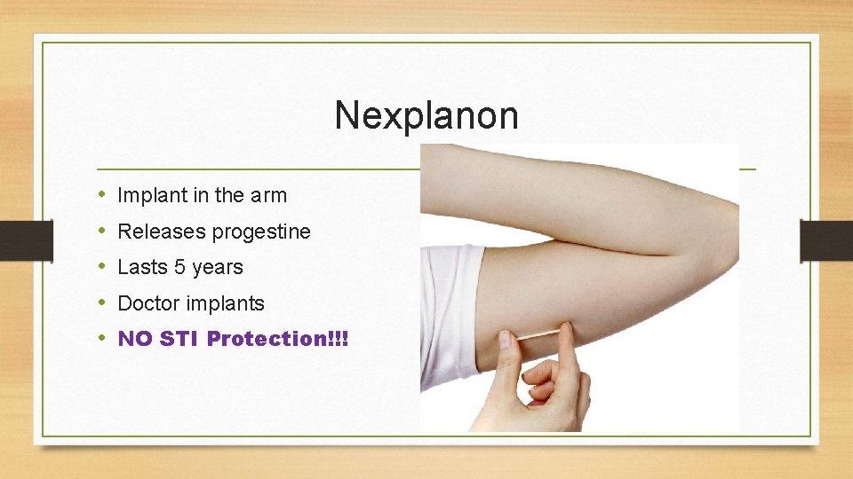 Nexplanon • • • Implant in the arm Releases progestine Lasts 5 years Doctor