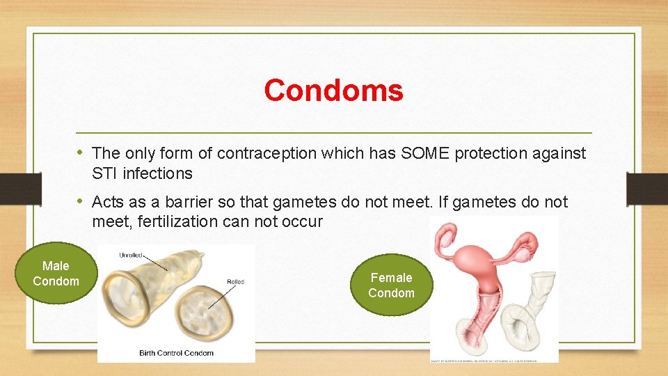 Condoms • The only form of contraception which has SOME protection against STI infections